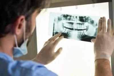 male dentist examining dental x-rays