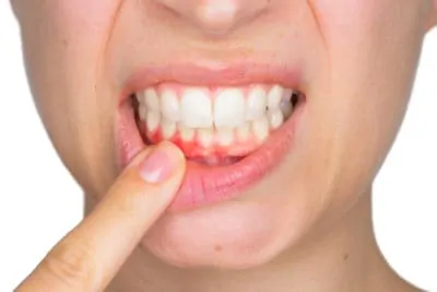 woman indicates gum irritation